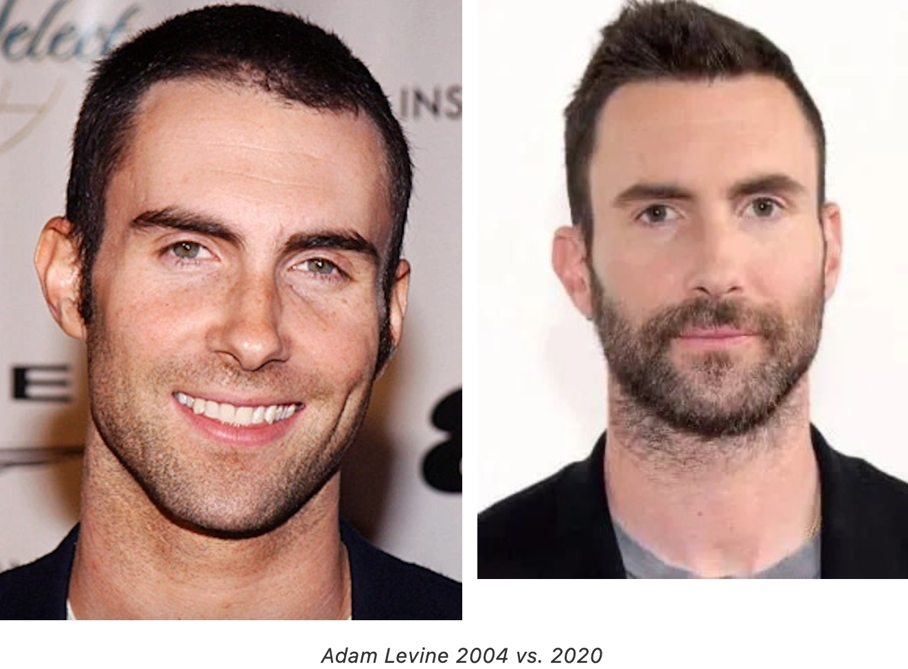 Why Asians look younger than white people? Academie de Bernadac